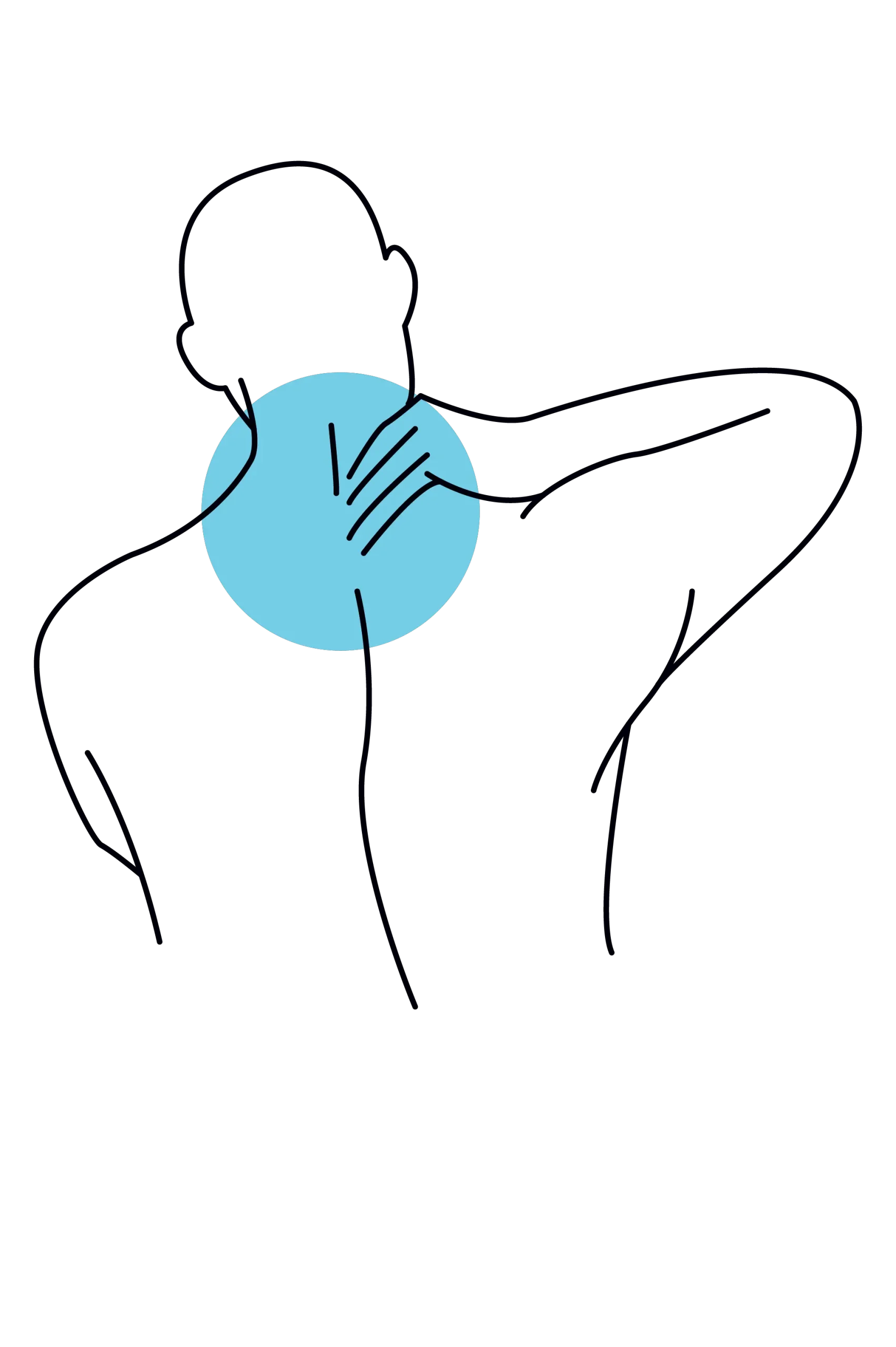 Neck pain illustration for chiropractor in Edinburgh