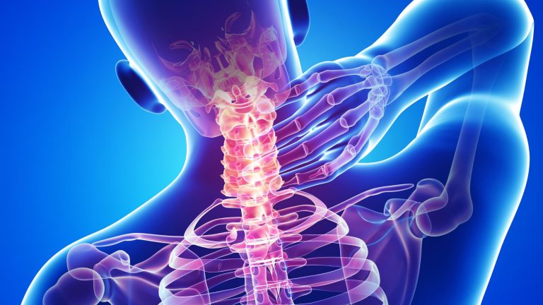 Cervical spine anatomy illustration highlighting pain in the neck